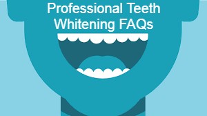 Professional Teeth Whitening FAQs